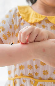 Researchers explore novel therapies to stall severe dengue as vaccine development gains momentum Researchers explore novel therapies to stall severe dengue as vaccine development gains momentum